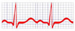 ecg